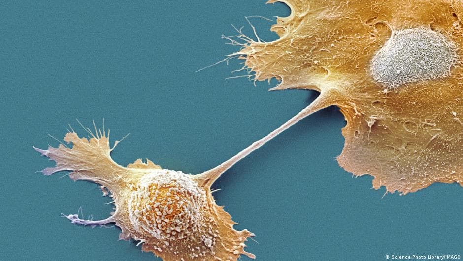Positive outcomes for pancreatic vaccine