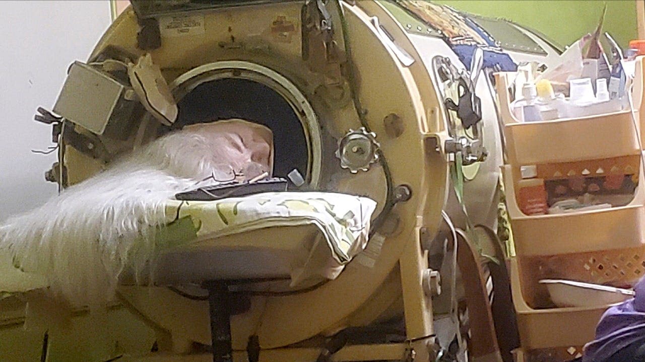 Last American Iron Lung User Dies at 78 Years Old After Childhood Polio Diagnosis