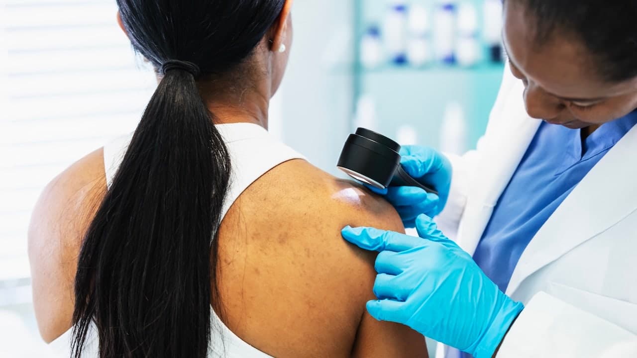 Cancer vaccine stops melanoma recurrence