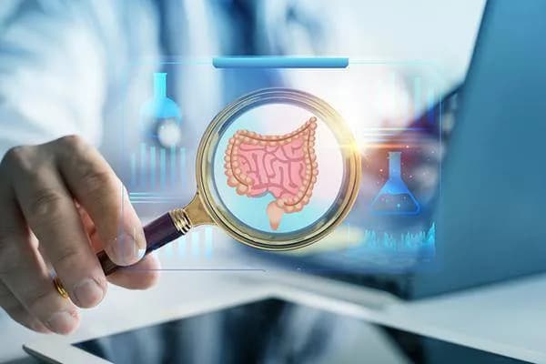 Recent Advances in Colorectal Cancer Tests