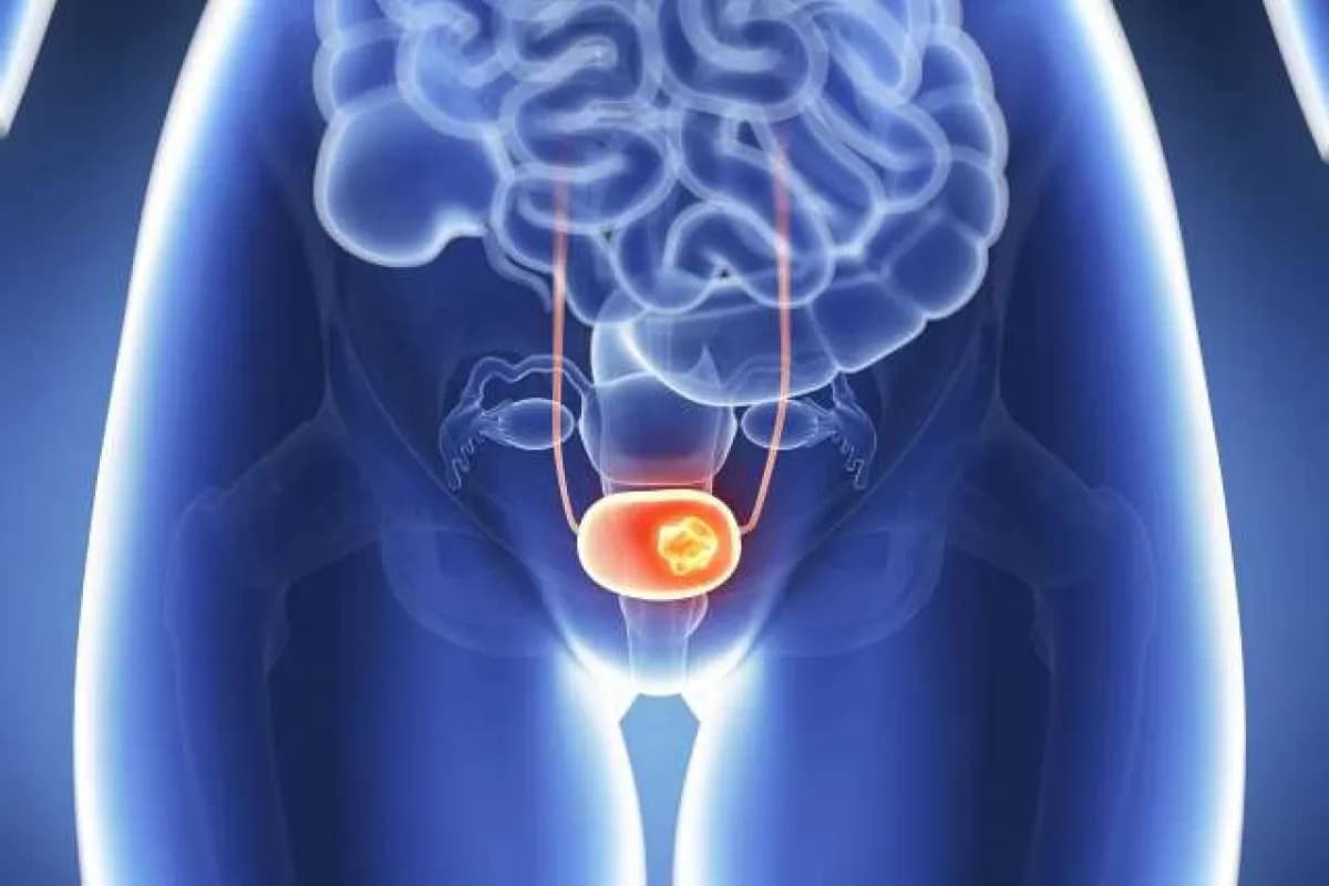 Foods Promoting Men's Bladder Health After 50
