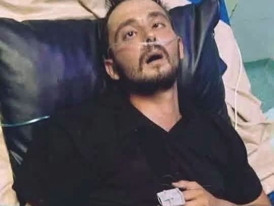 شاب يعاني من التعذيب في المخفر باللاذقية