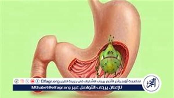طرق تشخيص جرثومة المعدة وعلاجها