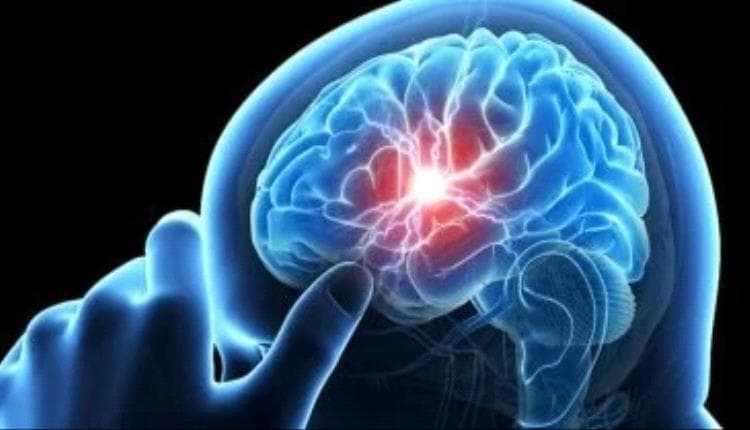 Hidden Causes of Alzheimer's