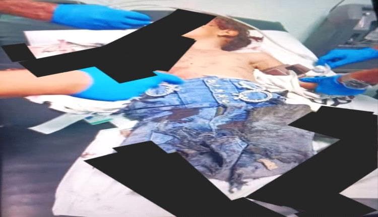 طفلة تتعرض لإصابة بانفجار في الضالع