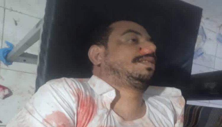 مالك محطات وقود بحضرموت يقتل بكمين في أبين