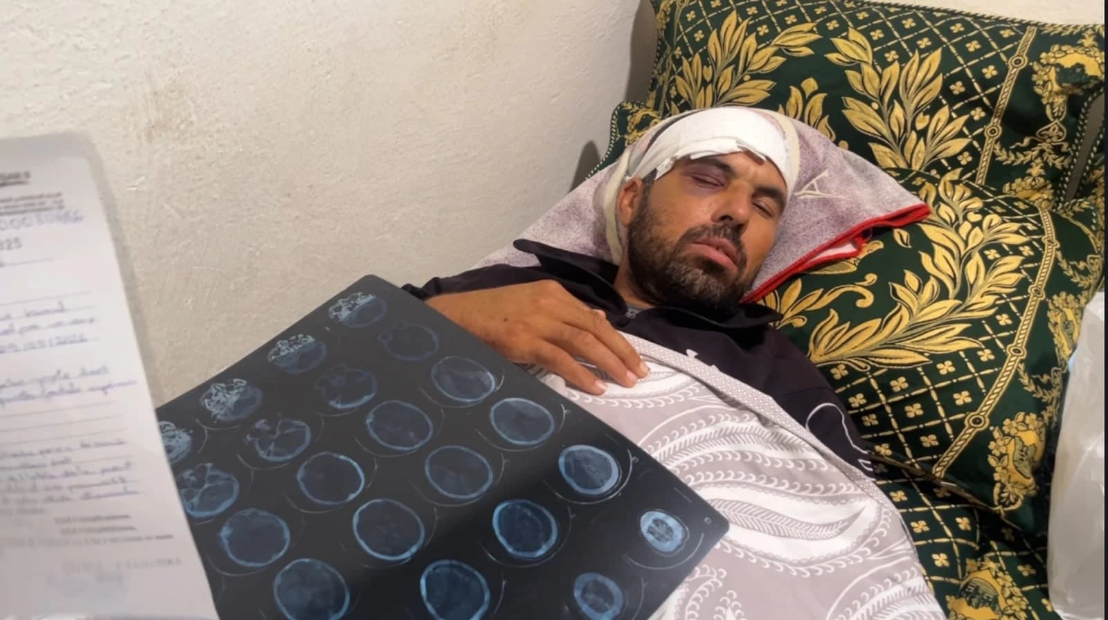 فلاح من تاونات ينجو من هجوم عائلي
