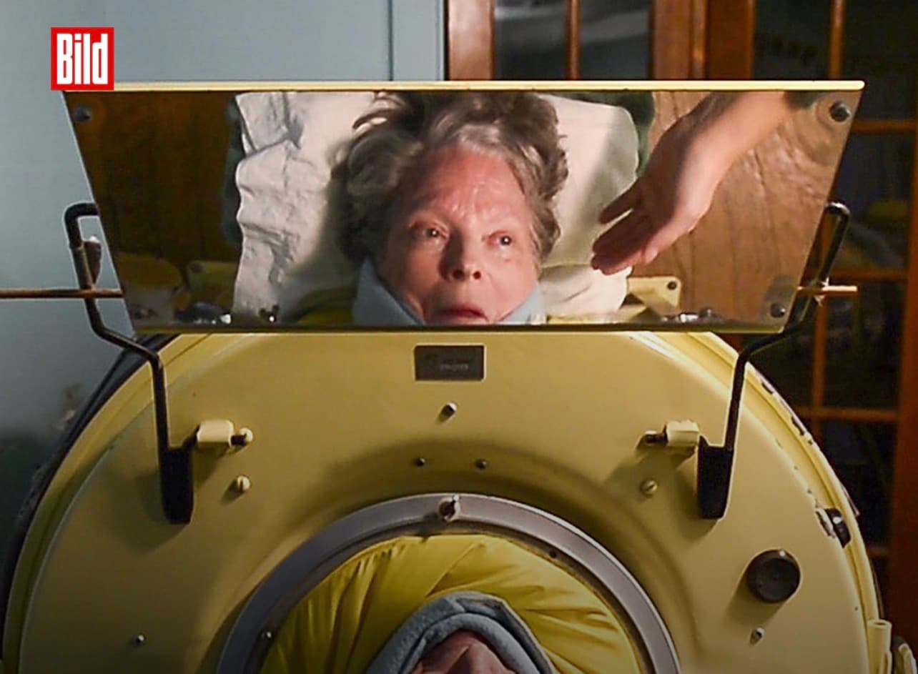 Last American patient living in an iron lung dies at age 78