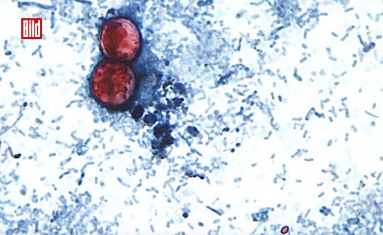 Parasite Causes Concern in the United States with Over 1,500 Cases of Severe Diarrhea and Health Alerts