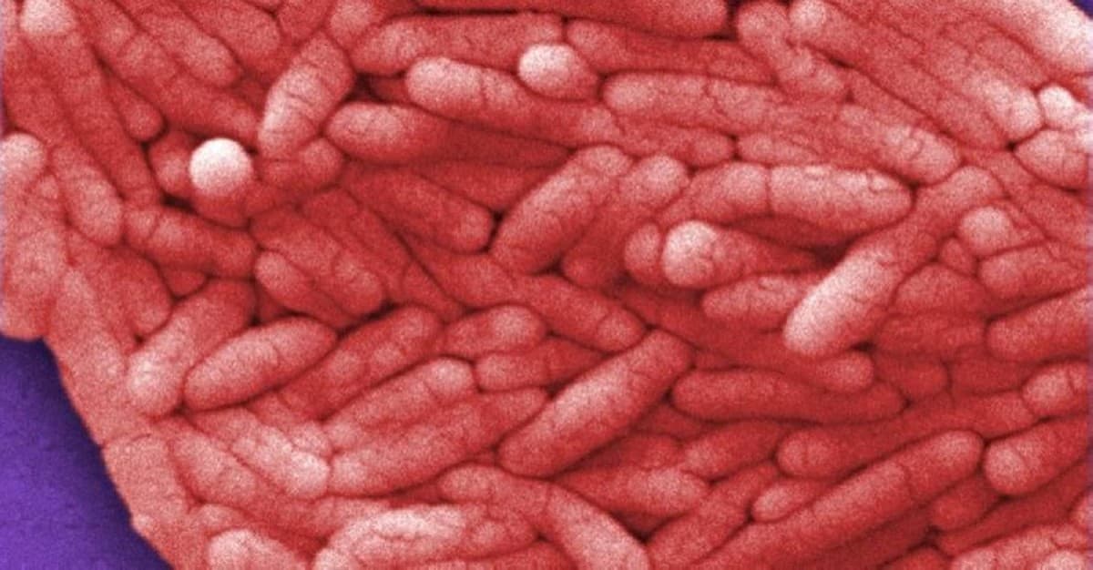 France reports 81 Salmonella cases from pumpkin seeds