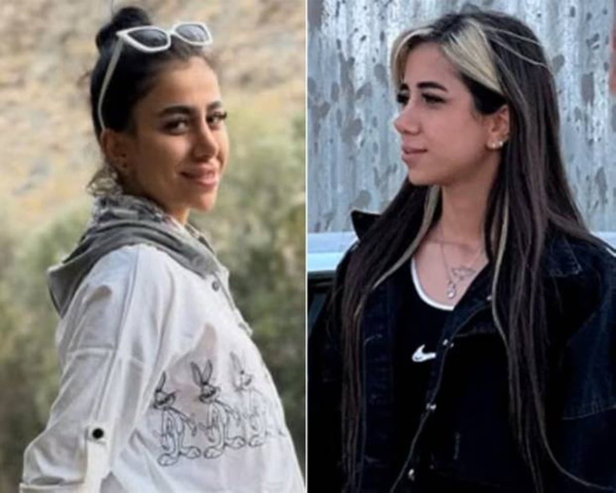 Iranian prison twins face injuries