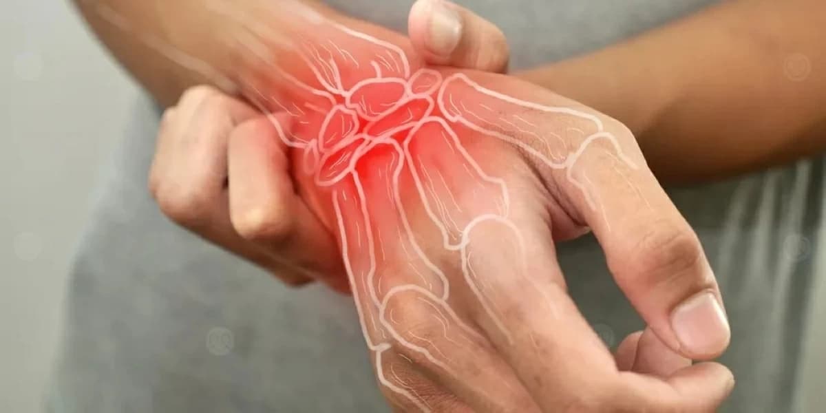 4 طرق طبيعية لتخفيف التهاب المفاصل