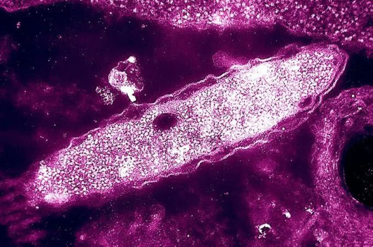 New York Driver Dies from Legionella