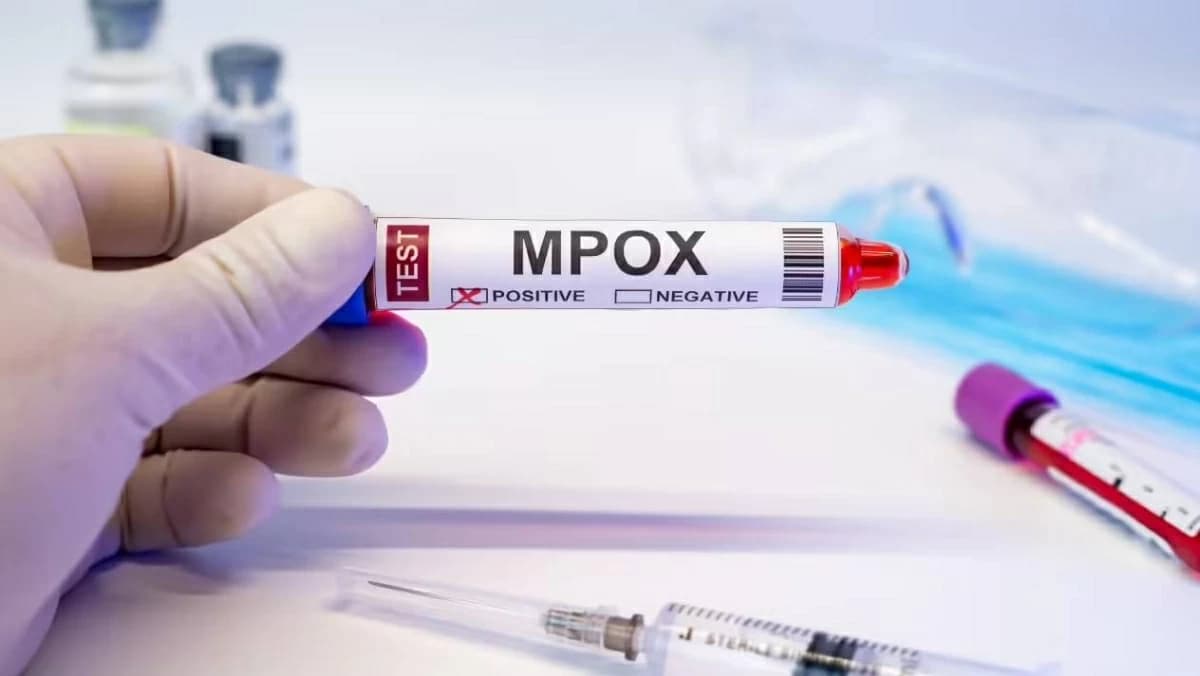 Madagascar reports 3,022 Monkeypox cases