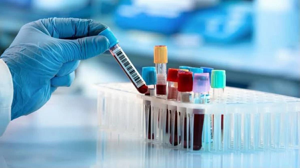FDA توافق على اختبار الكشف عن سرطان القولون