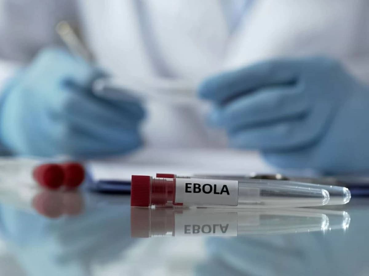 الصحة العالمية توصي باختبار إرفيبو ضد إيبولا