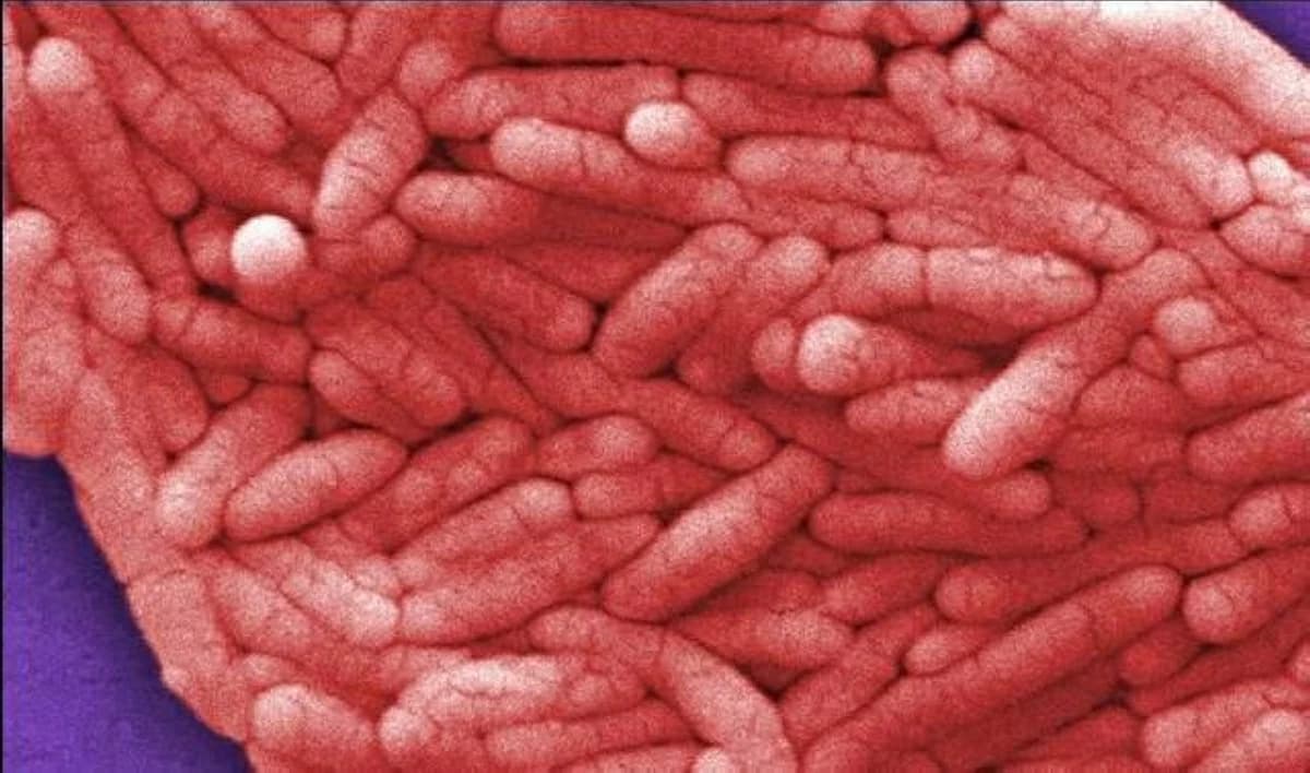 Widespread Salmonella Outbreak in Belgium