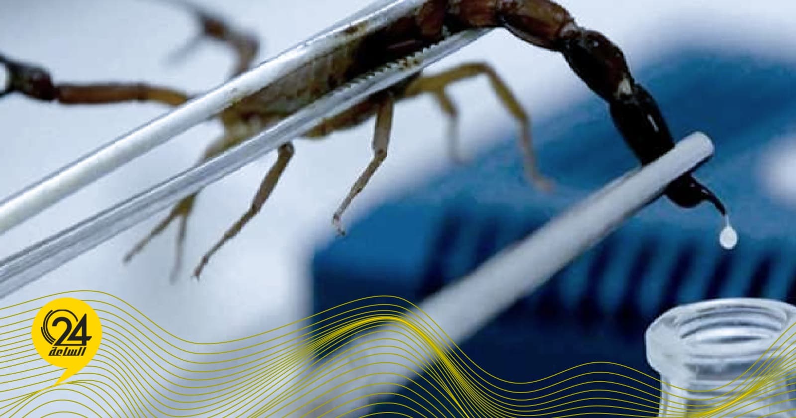 Al-Mahgoub confirms serum essential to counter scorpion venom