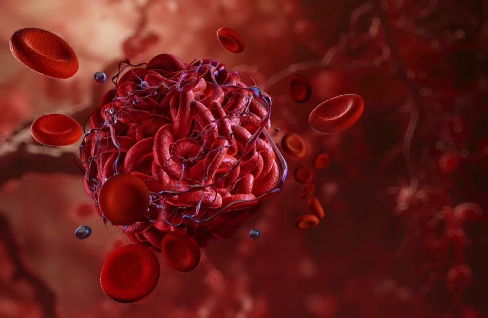 Smart wire visualizes the clot