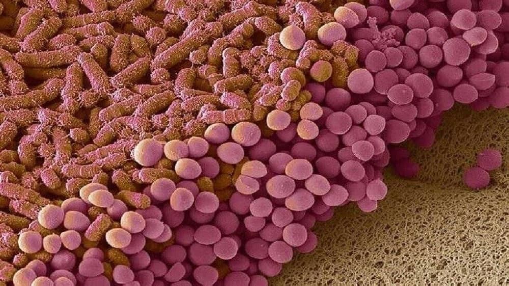 Gut bacteria shed light on early brain aging