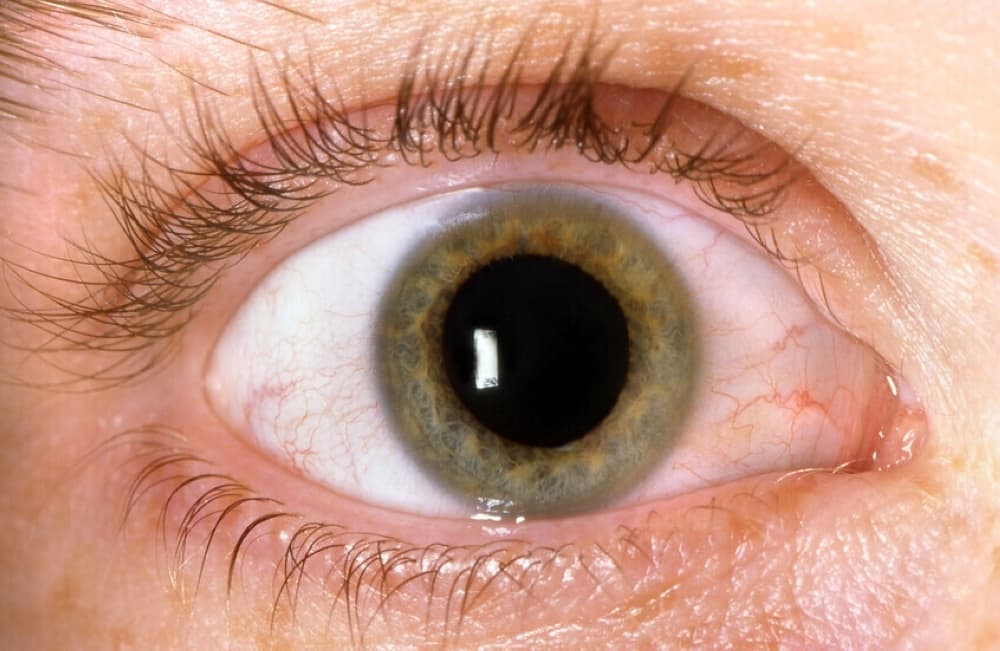 Dual-treatment eye lens