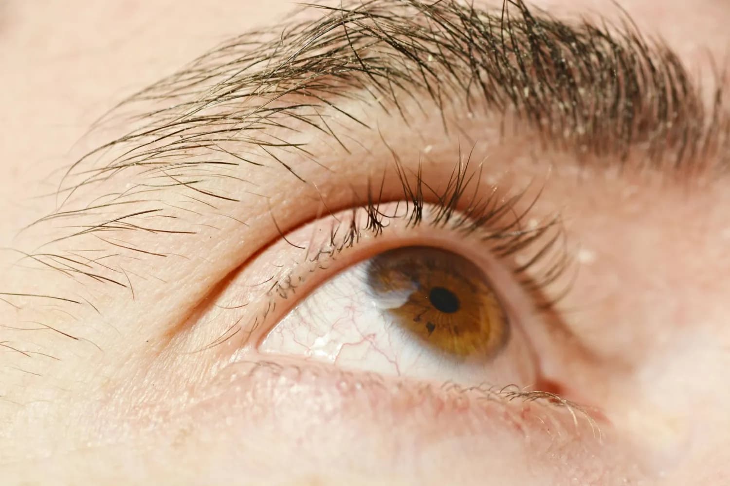 Signs of Omega-3 Deficiency