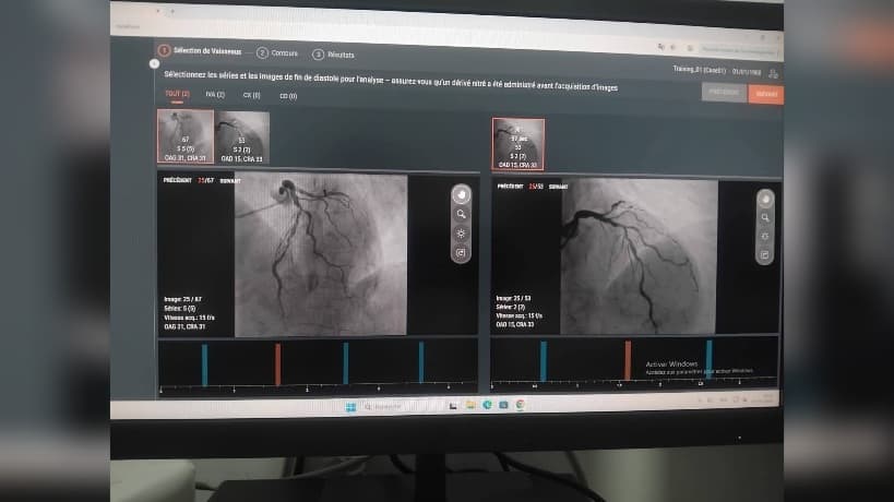 مدنين: لأول مرة تركيب وتشغيل برنامج تحليل QFR في المستشفى الجامعي