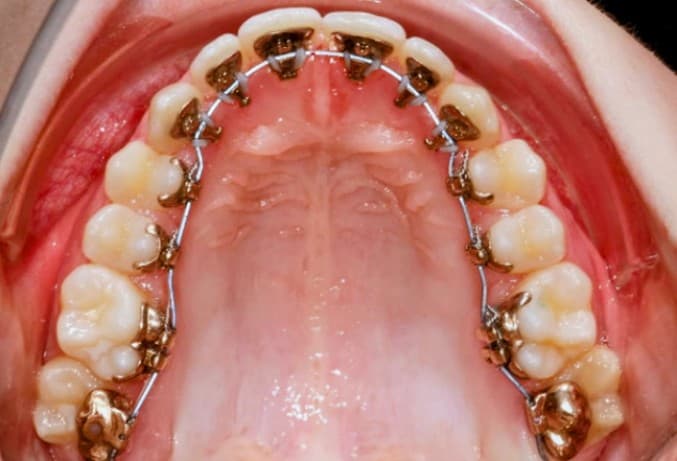 Kairouan: High Cost of Orthodontic Treatment Burdens Families Amid Calls to Expand Health Coverage