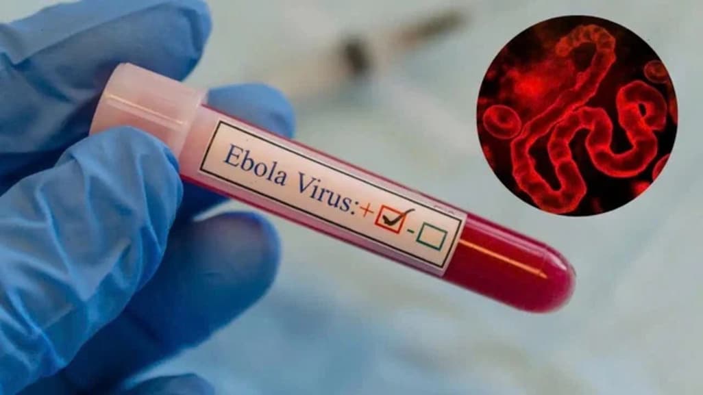 Ebola Outbreak in DRC Sees 1,657 Deaths