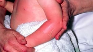 Evening incidents involve falls and fractures, drowning in lead, prompting calls for mothers to tighten supervision
