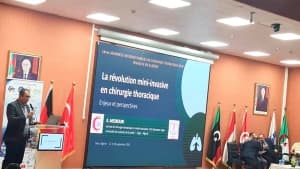 الجزائر تعلن قيادتها في جراحة الصدر بالمنظار