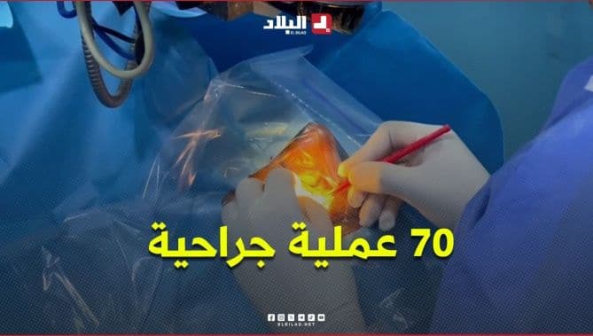 70 عمليات جراحية مجانية للعيون في يوم واحد