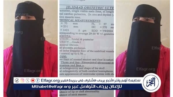 امرأة بالبحيرة تتهم الطبيب بالتسبب في وفاة جنينها