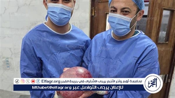 Asyut medical team removes large abdominal cyst