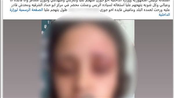ضبط متهم بضرب زوجة شقيقه بالشرقية