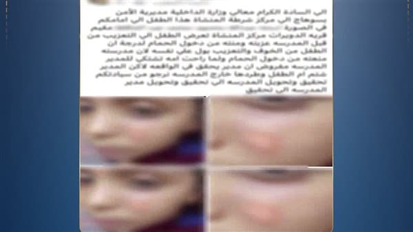 Guardian Raises Alarm Over Teacher Abuse of Student