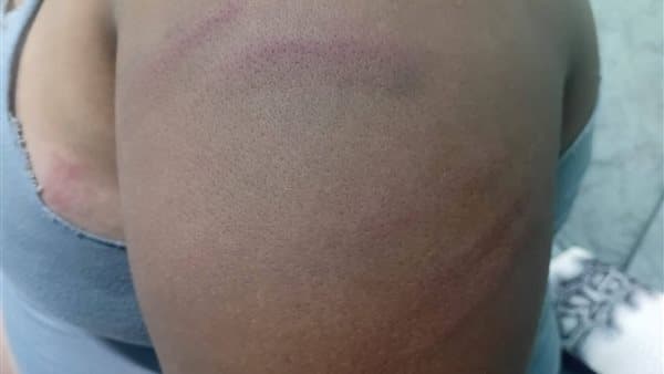 Guardian seeks help after son assaulted at Monti Prep