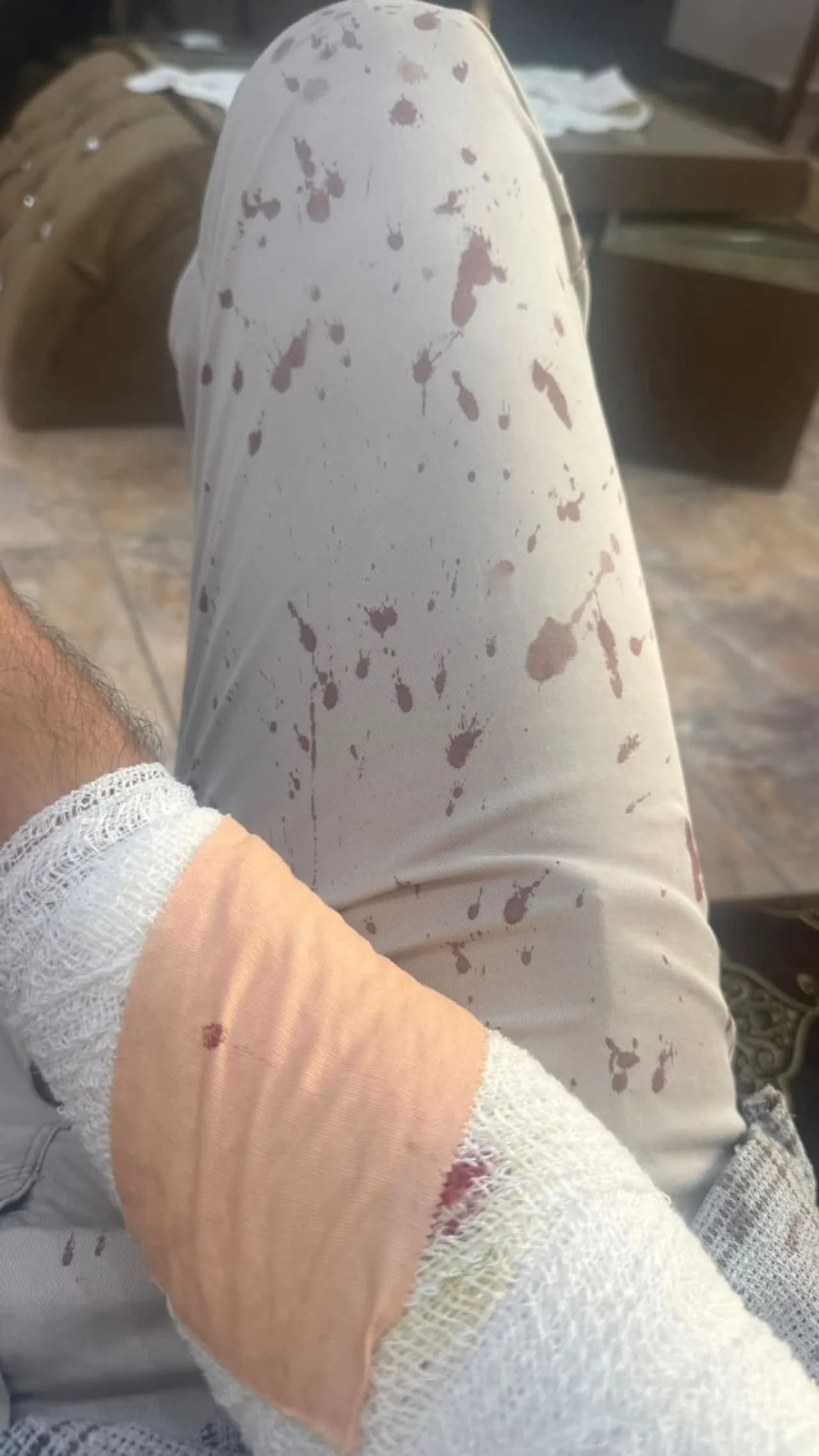 Student attacks teacher with saw in Zarqa