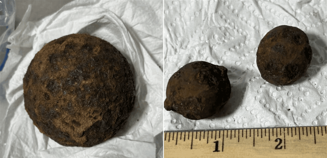 Historical shells spark debate at US airport