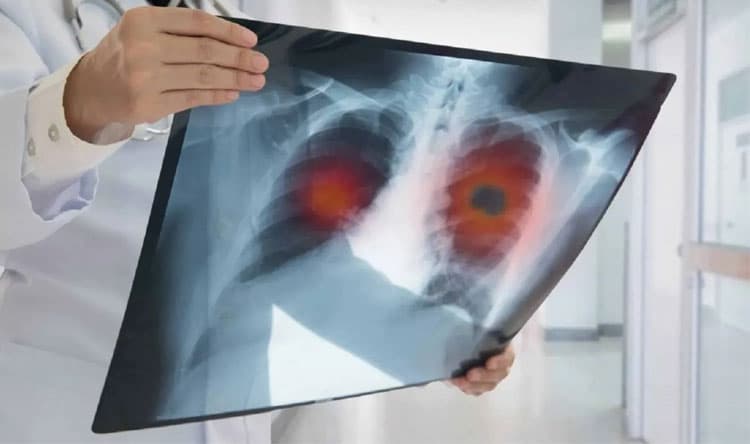 Lebanese Forces Identify New Infectious Cancer
