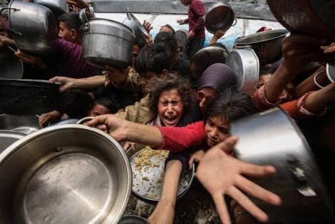 Gaza faces severe malnutrition