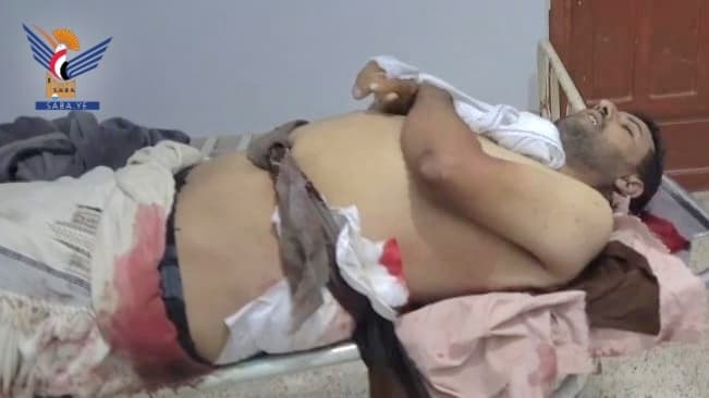 Saudi shelling in Al-Bayda causes casualties