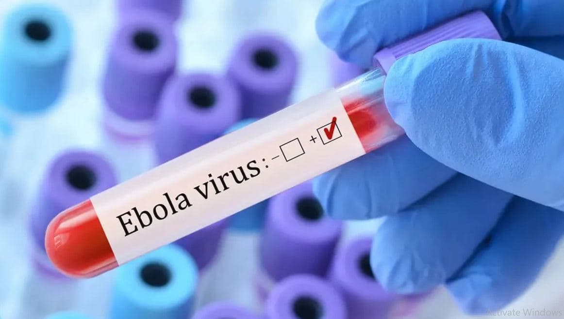 WHO advances as Ebola trials begin