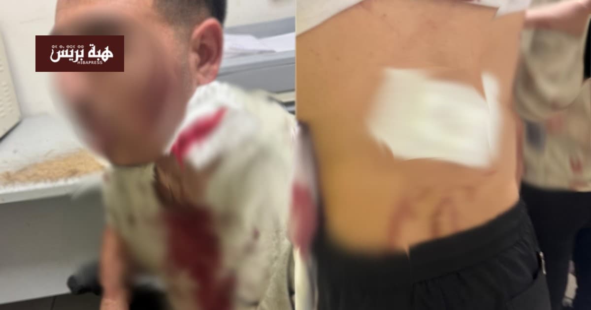 Heavily armed gang attack in Bernoussi
