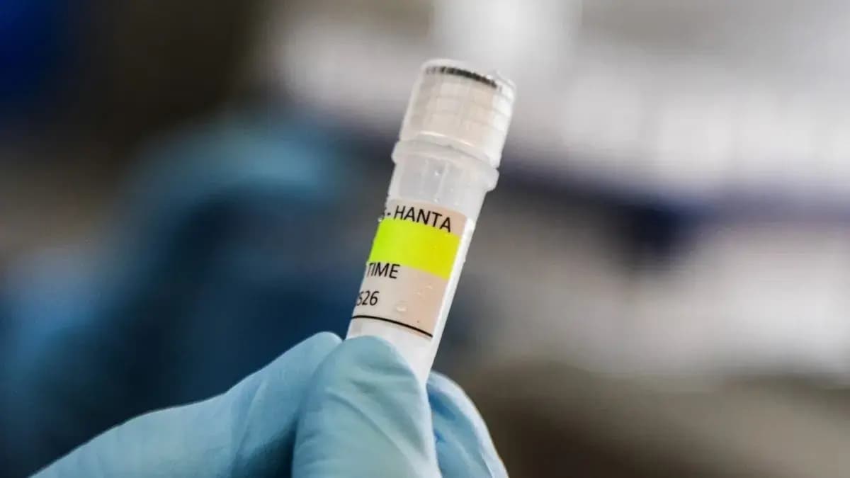Trump's AIDS Funding Cuts Risk Global Setback