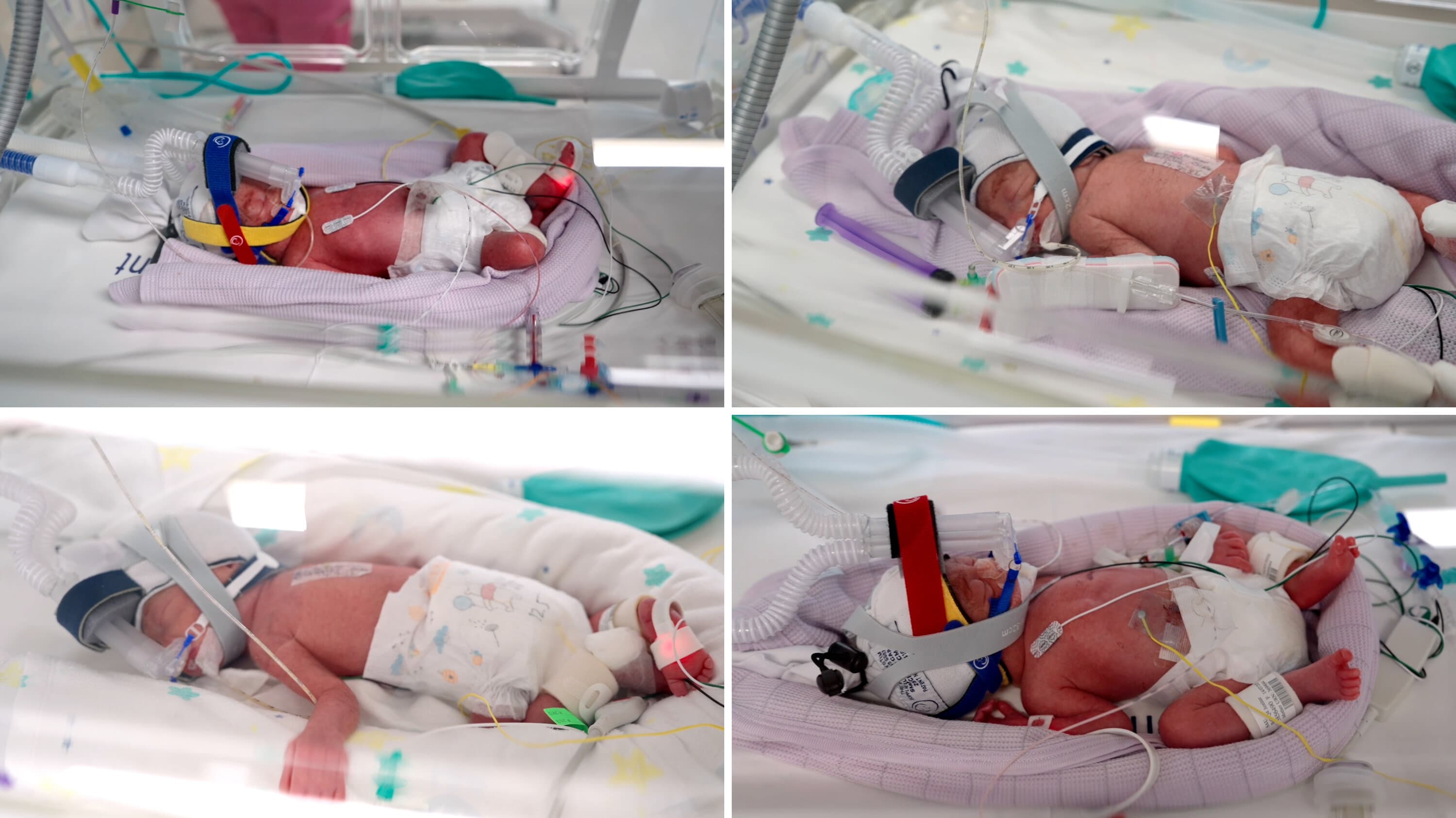 Australian woman delivers identical quadruplets