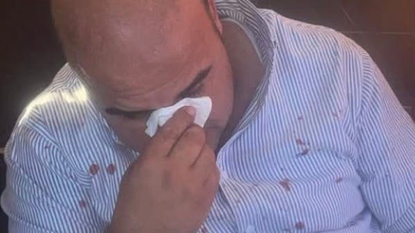 Egyptian Official Attacked During Removal of Illegal Encroachments, Security Reveals Reason