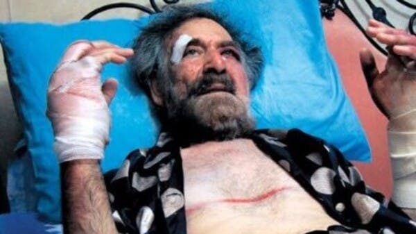 Syrian minister praises injured artist
