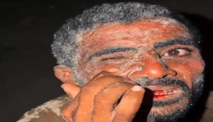 Yemen News: Mukalla Town Festival Disrupted